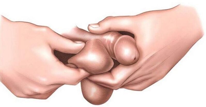 Why are the eggs itch in men